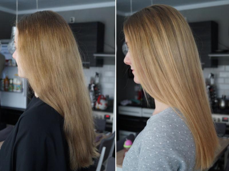 Naturalne sposoby na lekkie refleksy