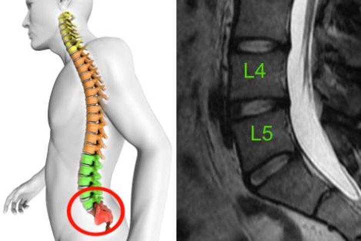 Jak bezpiecznie sprawdzić, czy na L4 można wychodzić z domu?